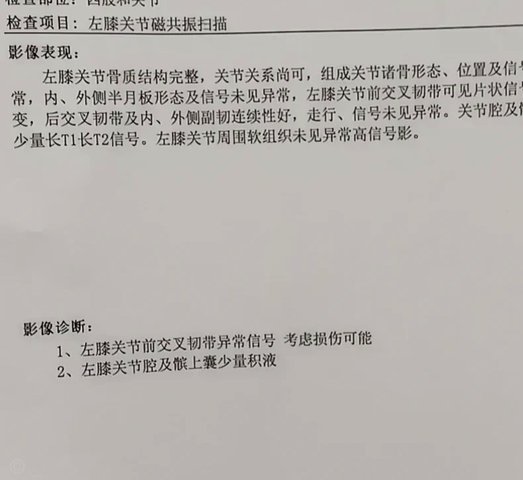 谢蒂内拉伤至少两周恢复